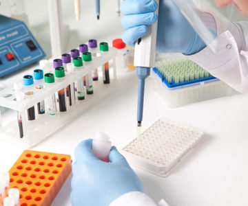 Biochemical tests and Histopathology